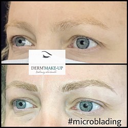 Microblading