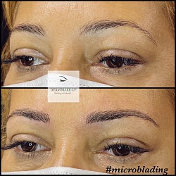 Microblading