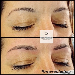 Microblading