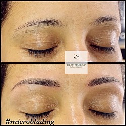 Microblading